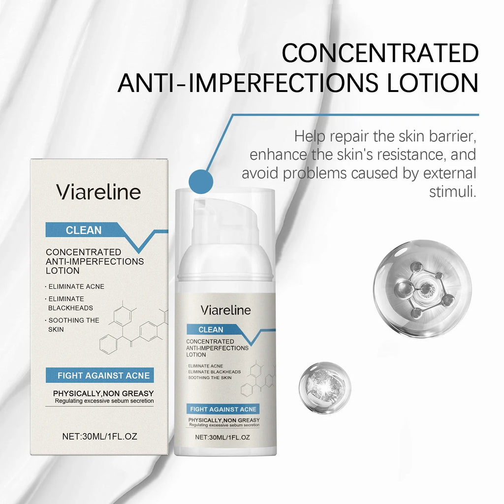Viareline Salicylic Acid Acne Lotion – Clear Blackheads 30ml
