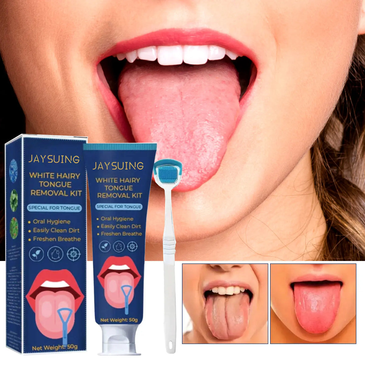 Oralhoe Tongue Cleaning Gel & Scraper – Fresh Breath 50g