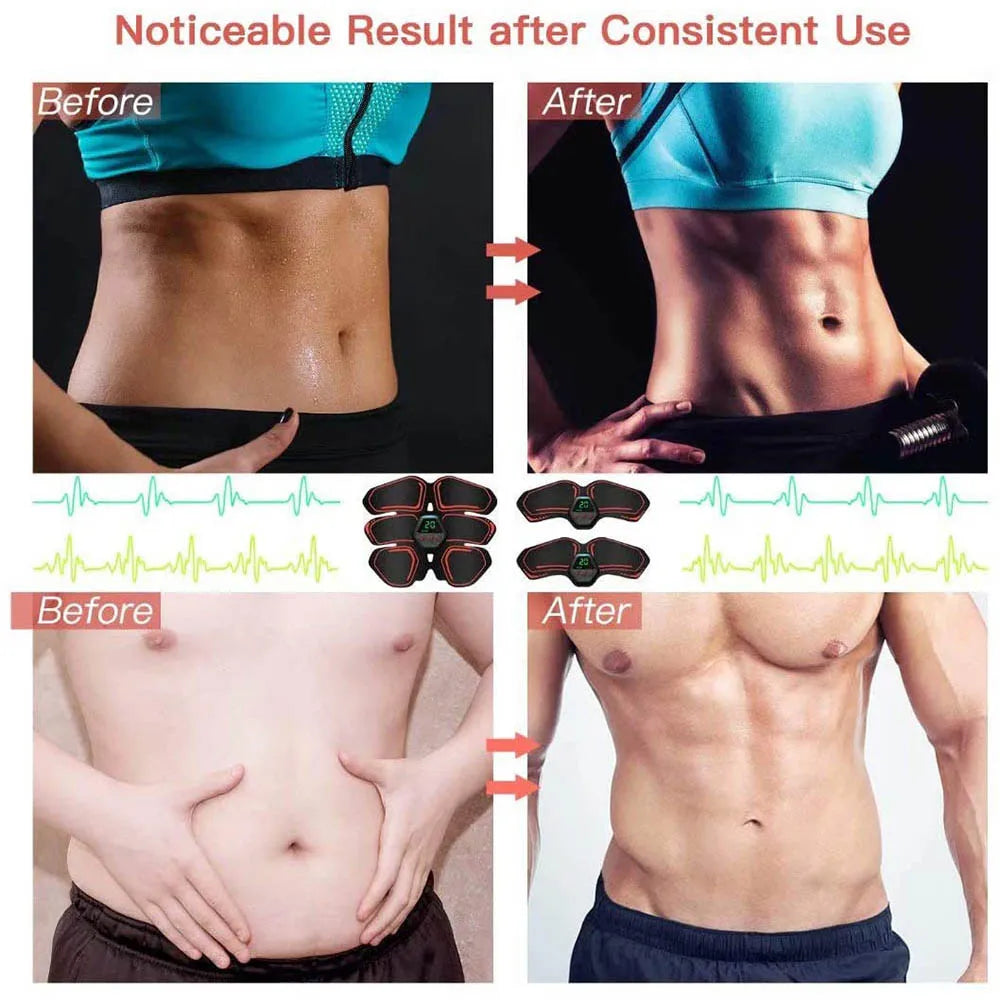 EMS Abs Stimulator Belt – Muscle Toner for Men & Women