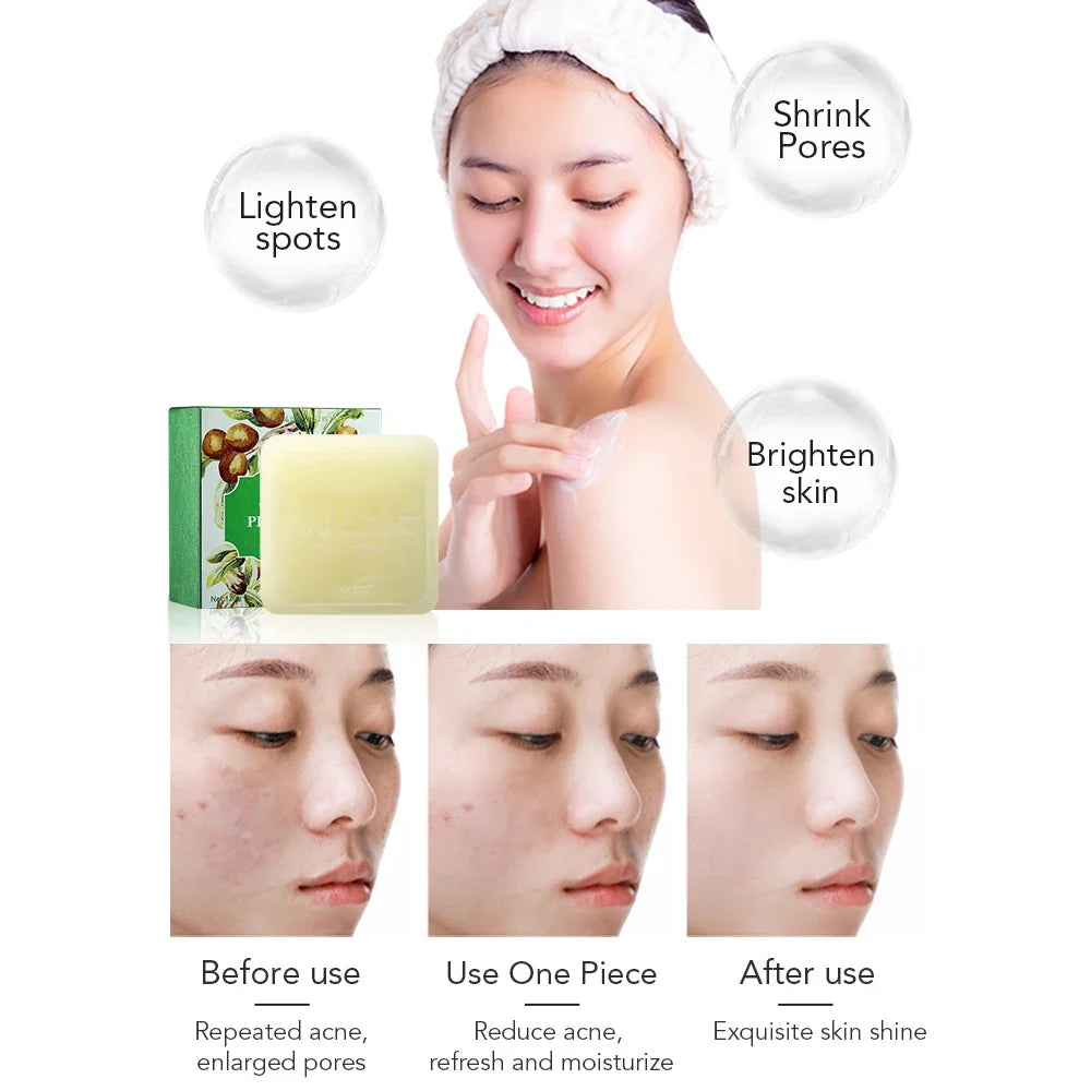 AILKE Shea Butter Brightening Soap – All Skin Types 120g