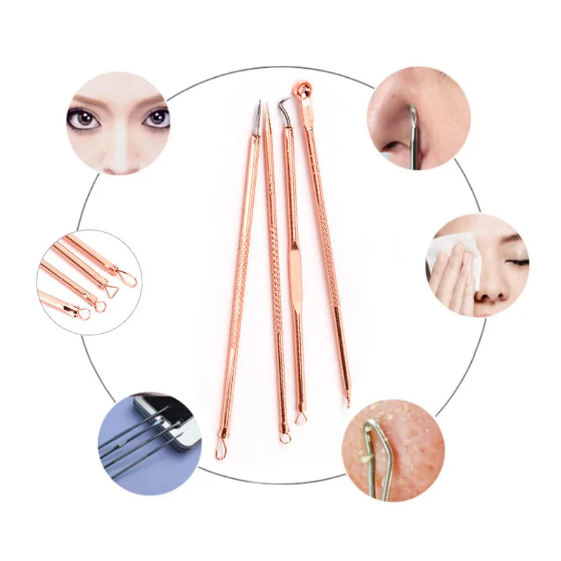 4-Piece Blackhead Extractor Tool Set | Stainless Steel Pore Cleaner