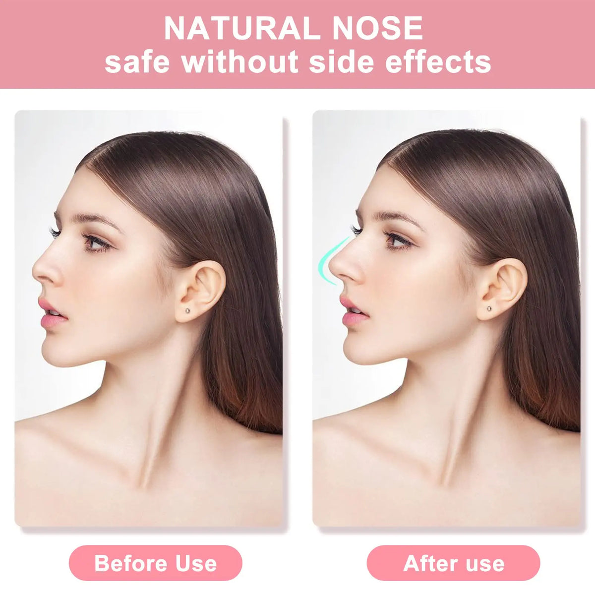 Nose Shaper Lifting Clips – 2 Sets, 3 Sizes | Silicone & Acrylic
