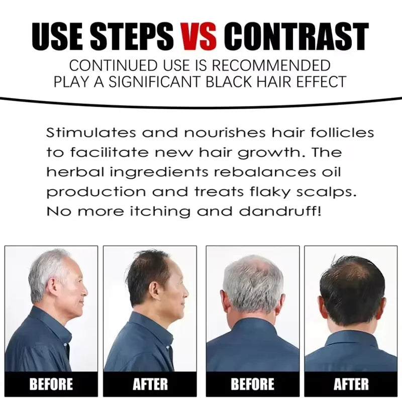 Herbal Hair Dye Shampoo – Natural Black & Grey Coverage