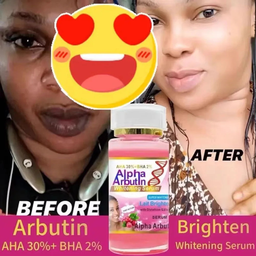 Alpha Arbutin Serum AHA 30% BHA 2% Brightening Face Cream