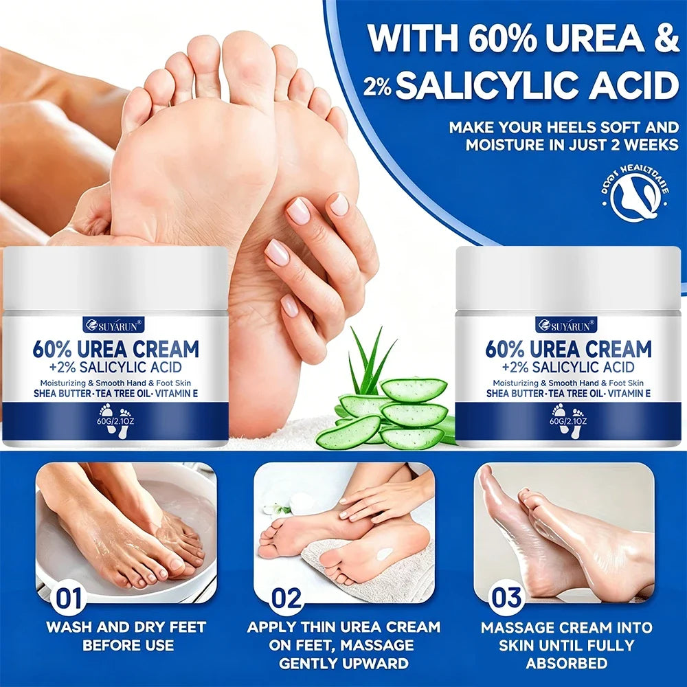 SUYARUN 60% Urea Foot Cream – Cracked Heels & Dry Skin