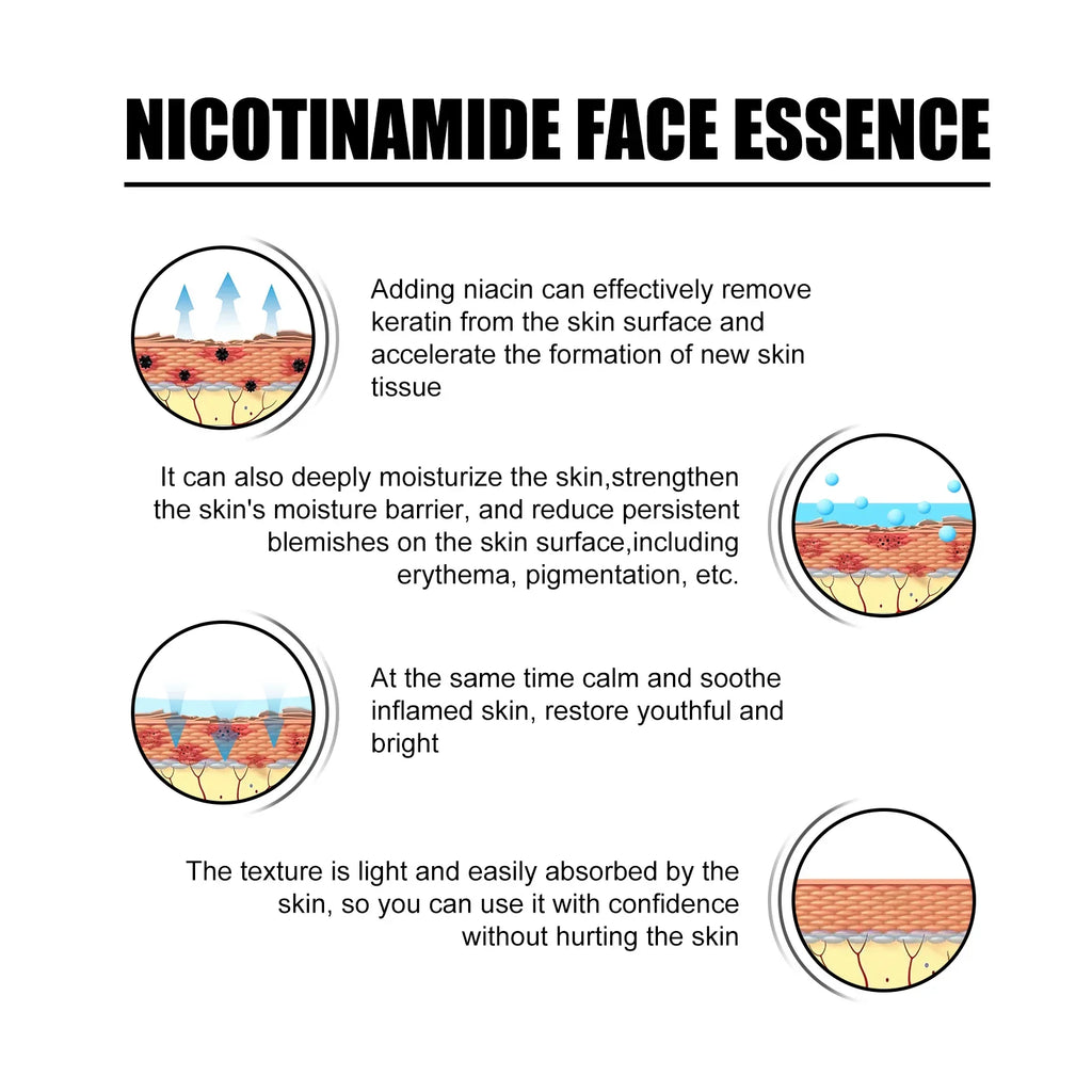 Eelhoe Niacinamide Serum – Fades Acne Marks & Brightens Skin