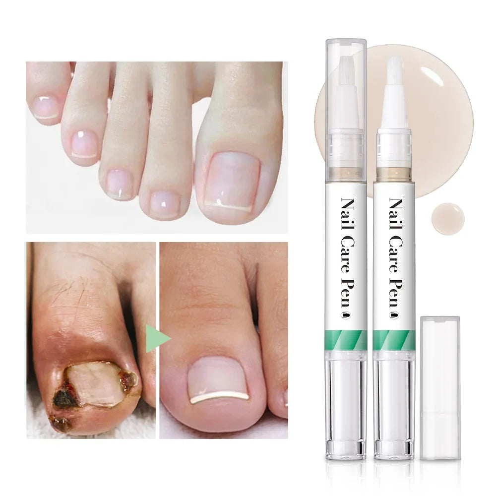 Nail Growth Cuticle Oil Pen – 2-Pack Nail Treatment | ibcccndc