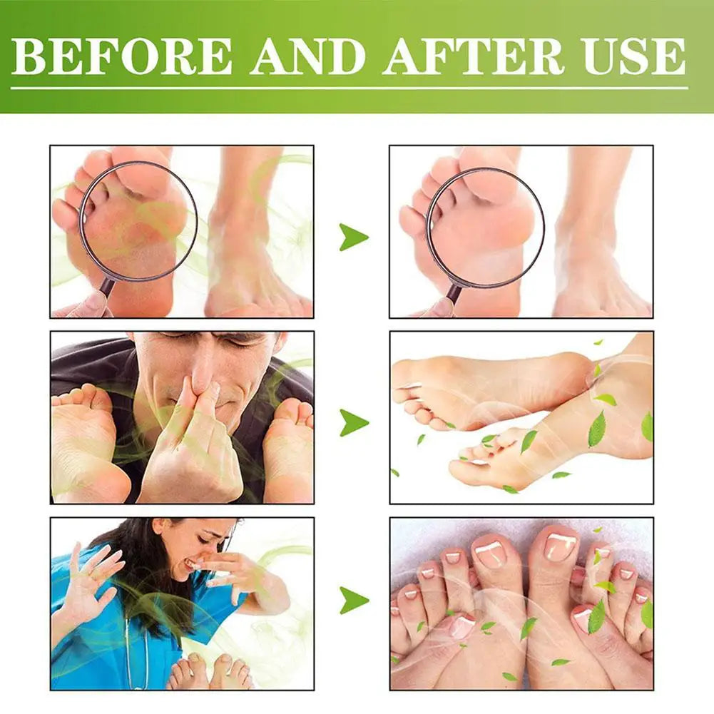 30ml Natural Foot & Shoe Deodorizer Spray | Fresh Dry Feet