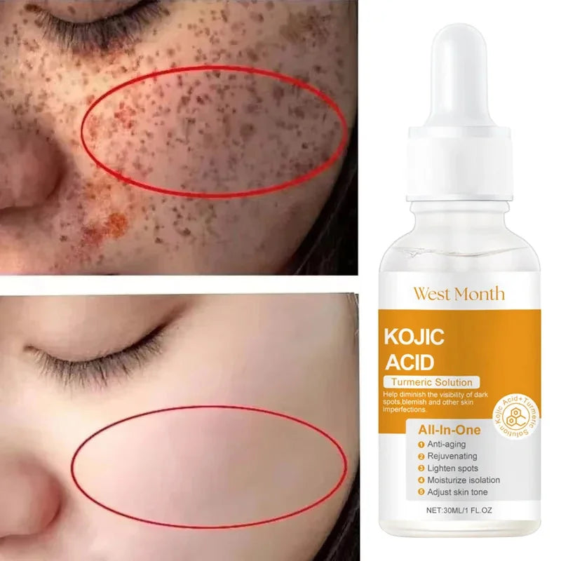 Kojic Acid Brightening Serum – Dark Spot & Tone Corrector