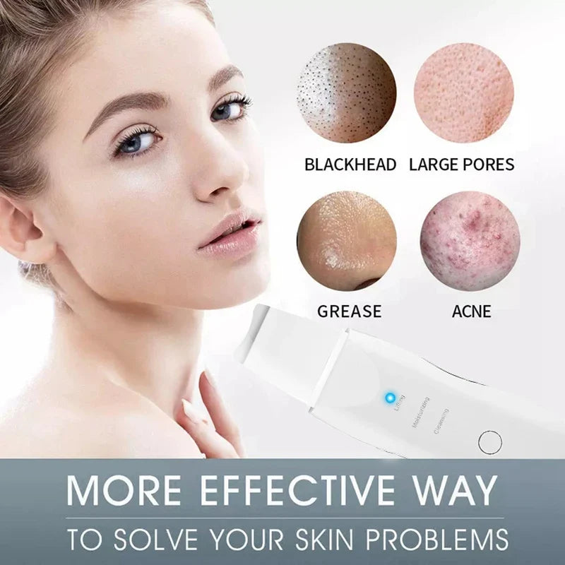 Ultrasonic Pore Scrubber – Blackhead Removal & Skin Peeling Tool