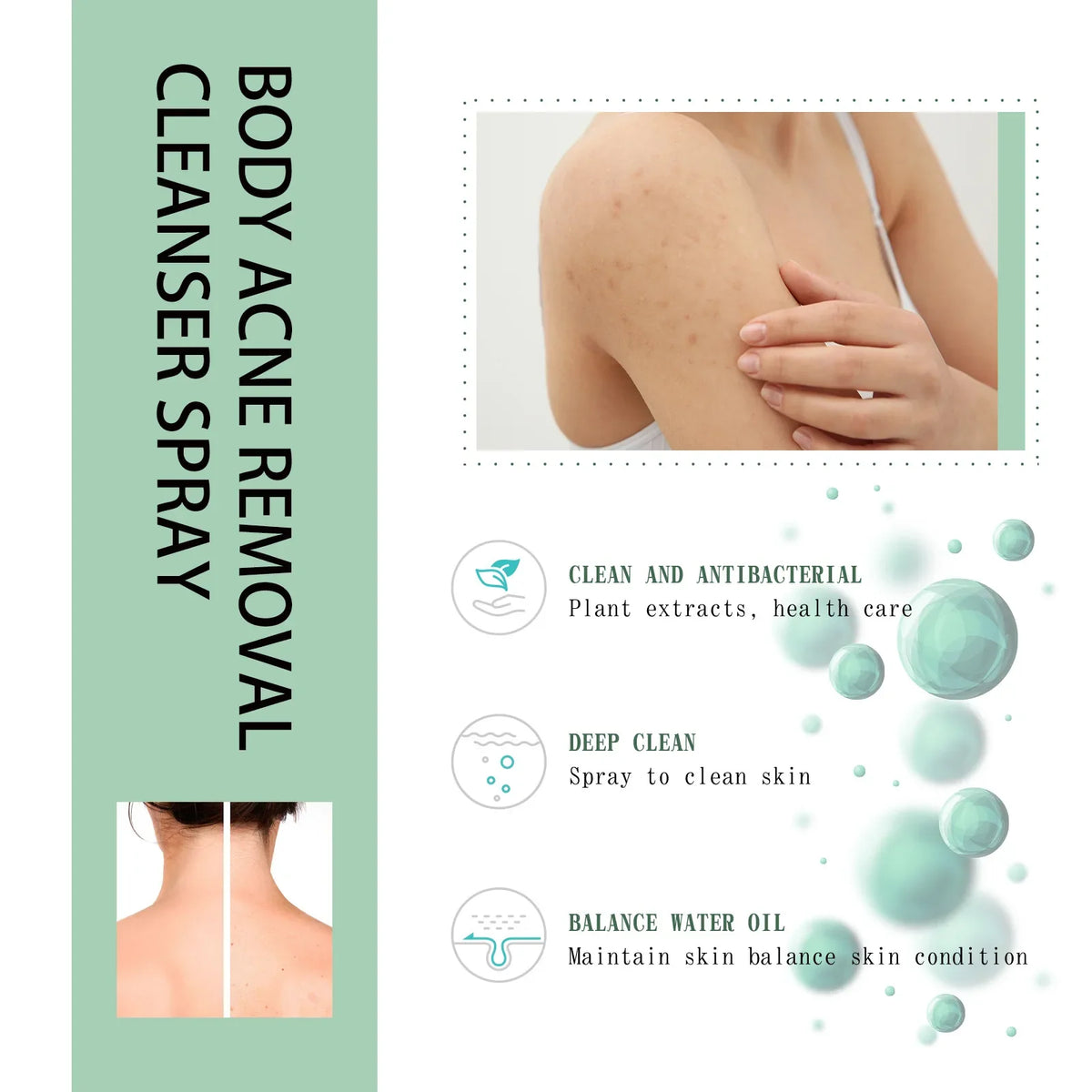 Eelhoe Back & Body Acne Repair Spray | Pore & Oil Control