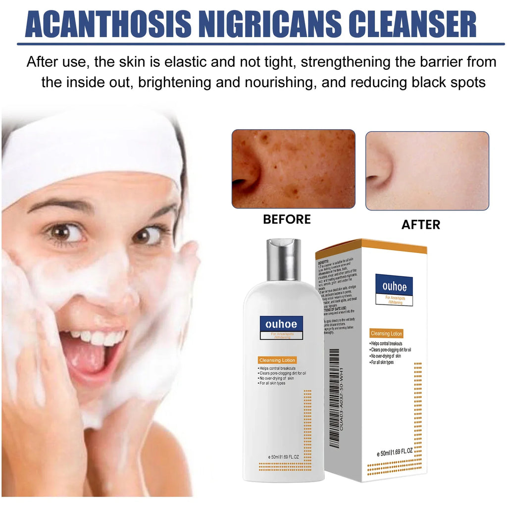 Brightening Face Wash – Oil Control & Blackhead Cleanser 50ml