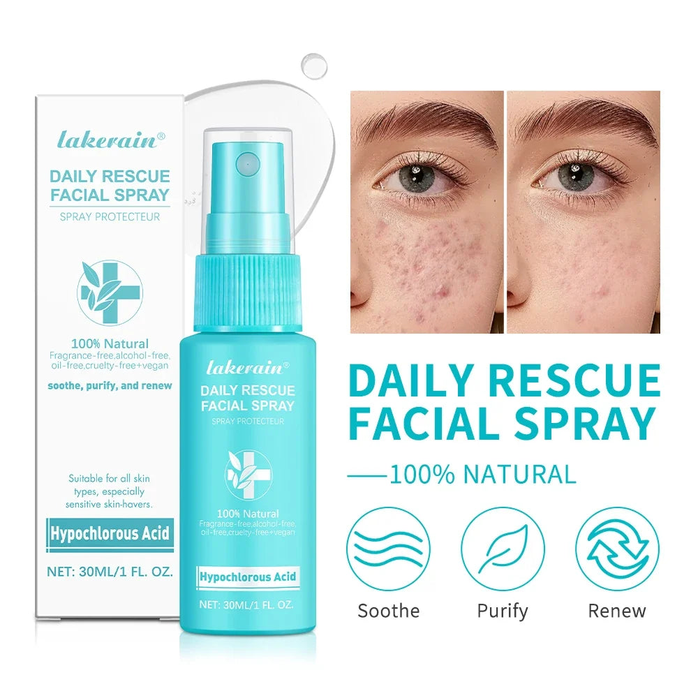 Hypochlorous Acid Facial Toner Spray – pH Balance, 30ml
