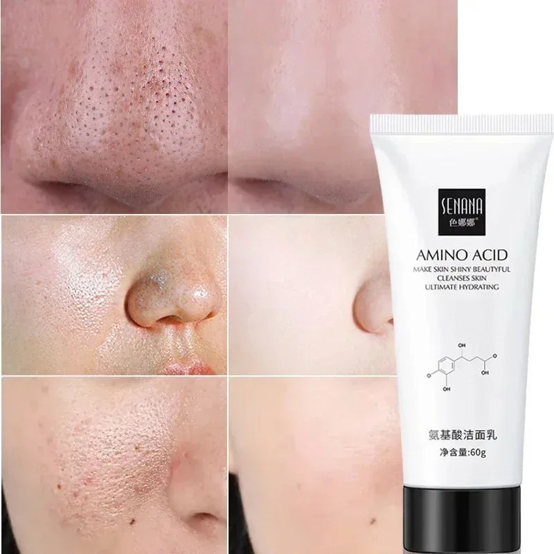 Nicotinamide Amino Acid Face Cleanser Facial Scrub Cleansing Acne Oil