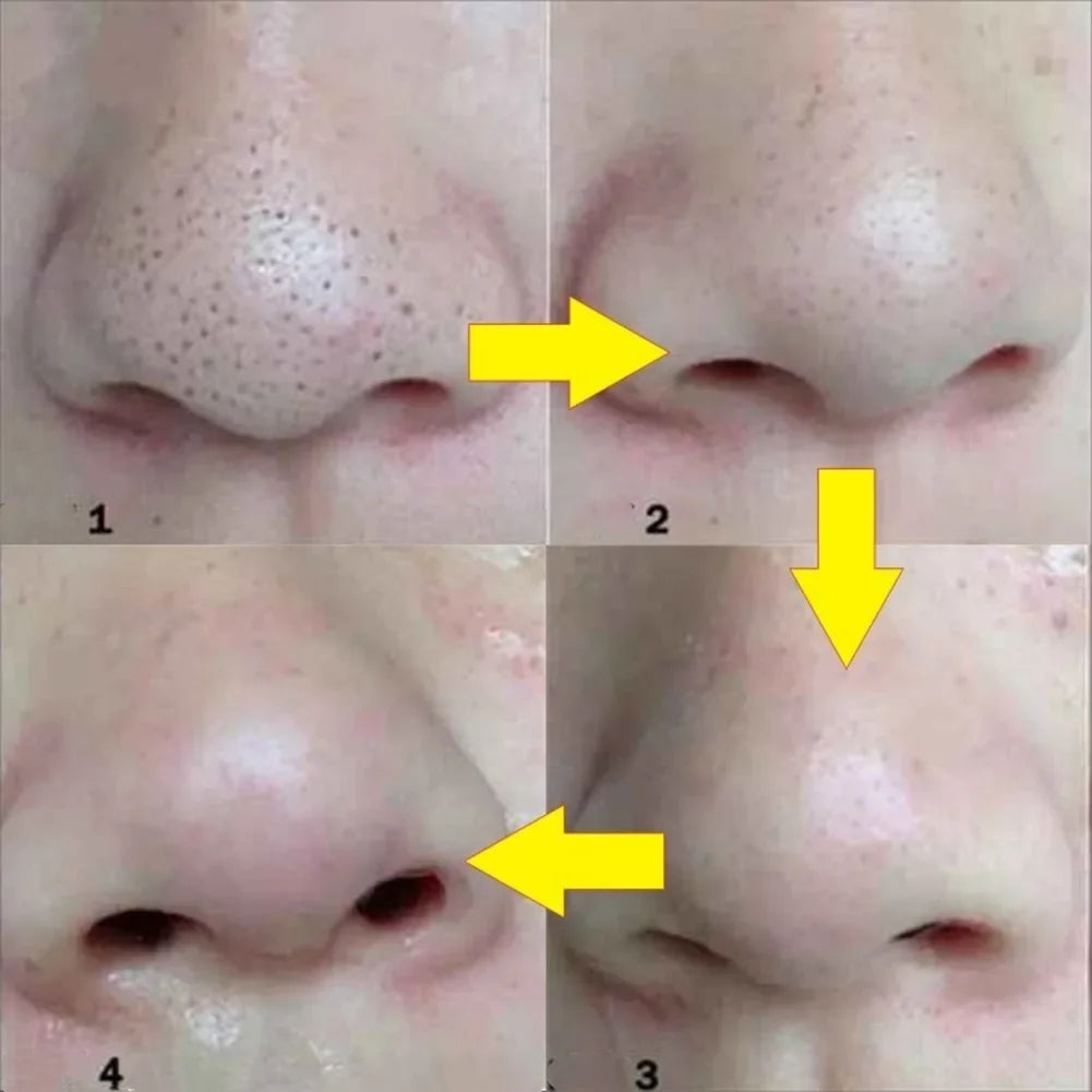 Bamboo Charcoal Nose Pore Cleansing Strips 50/100 Pcs