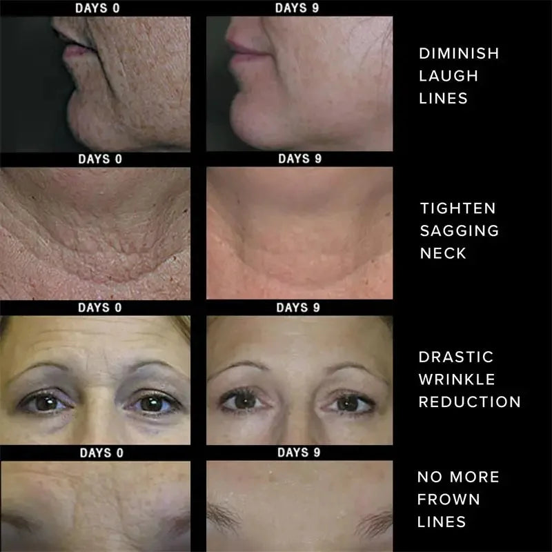 Retinol Face Cream – Firming, Anti-Aging & Moisturizing