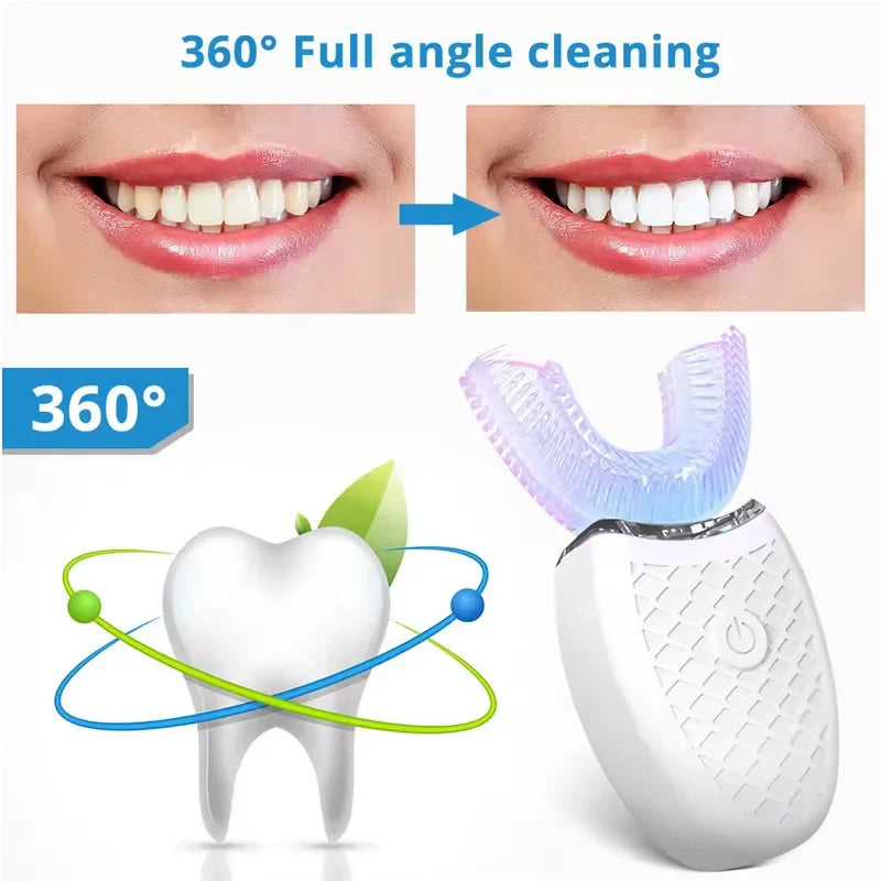 U-Shaped Electric Toothbrush – 360° Hands-Free Whitening