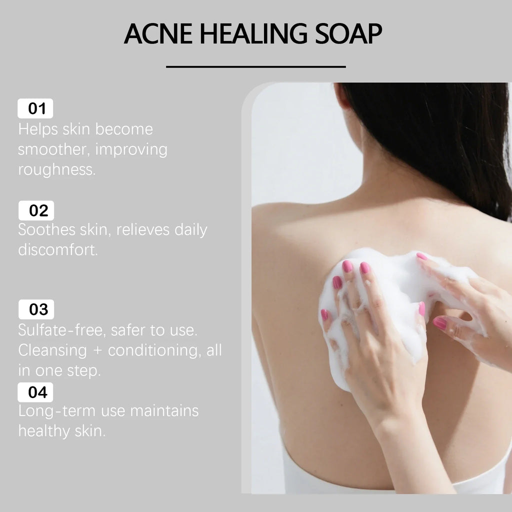 Natural Moisturizing Body Soap Bar – Brightening & Deep Clean 100g