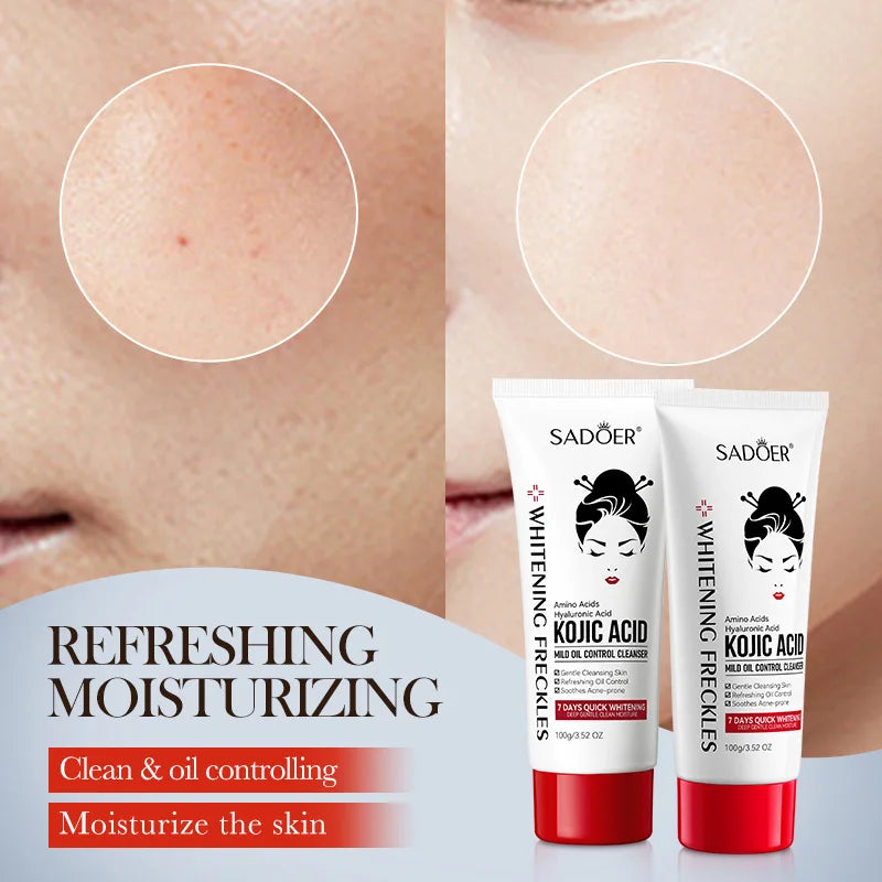 SADOER Kojic Acid Facial Cleanser – Brightening Face Wash