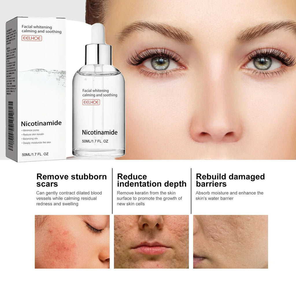 Eelhoe Niacinamide Face Serum – Fade Dark Spots & Brighten Skin