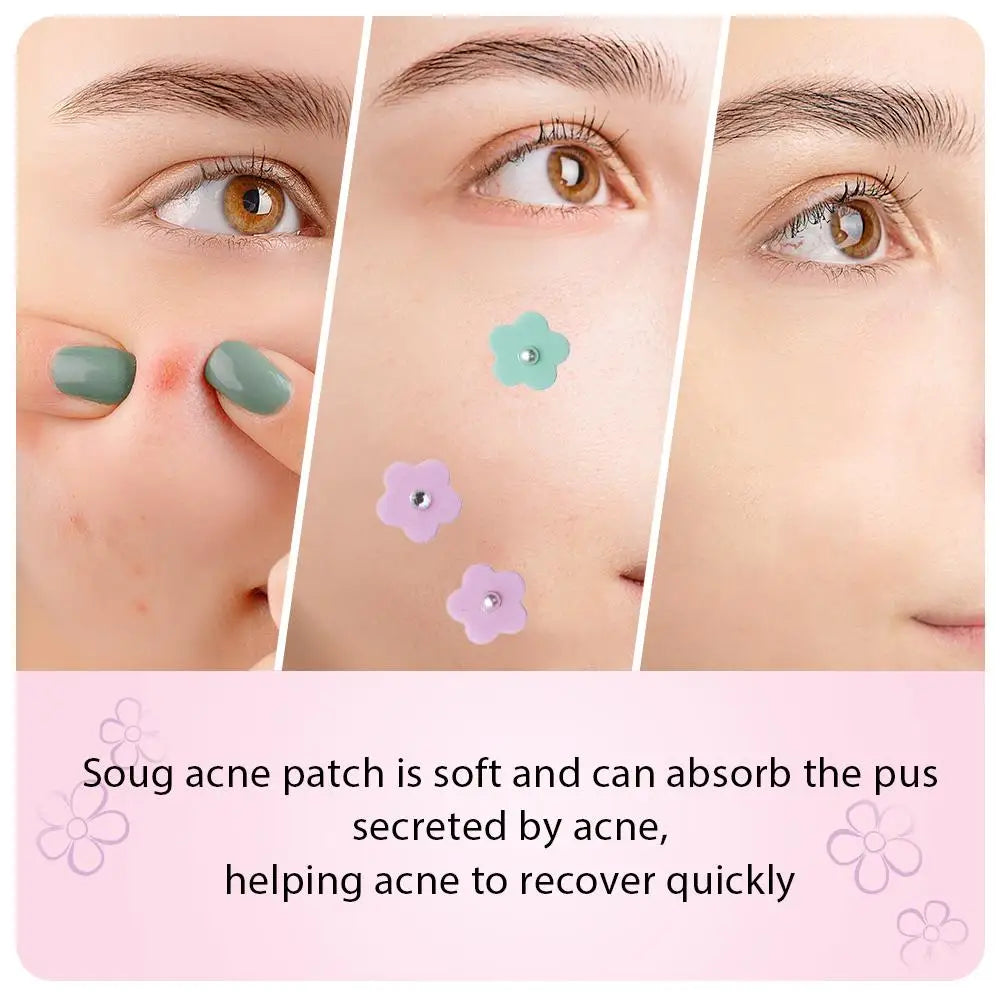 Flower-Shaped Hydrocolloid Pimple Patches – 20 or 60 Pcs