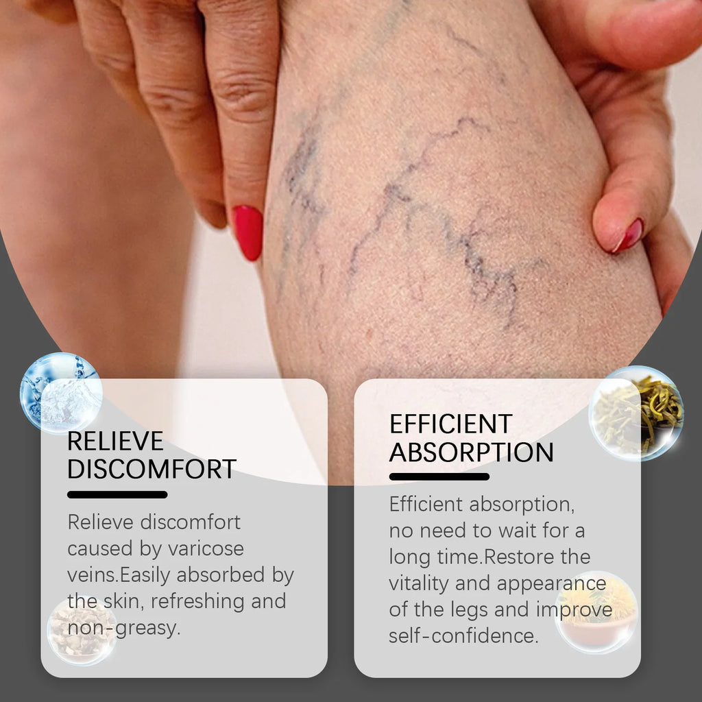 OceAura Leg Vein Cream – Cooling & Circulation Support