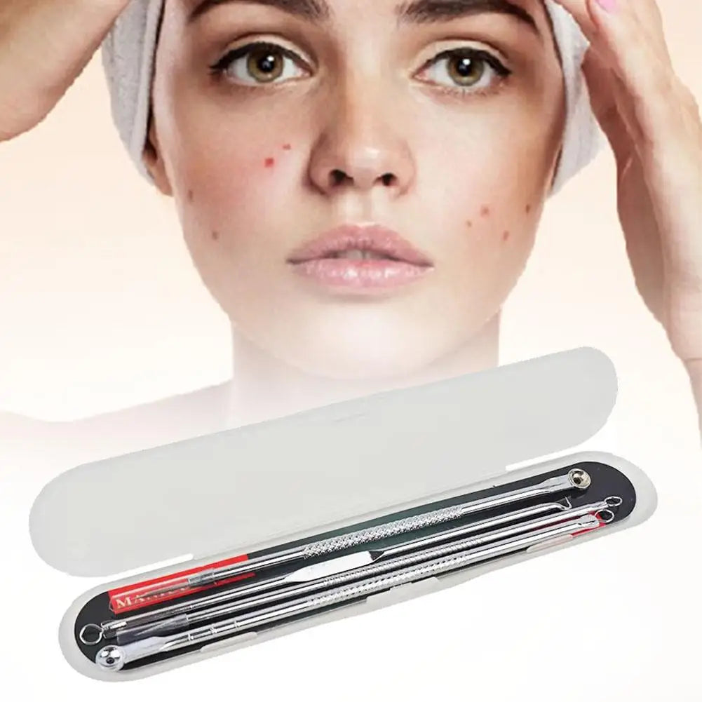 4-Piece Blackhead Remover Tool Set – Stainless Steel Acne Kit