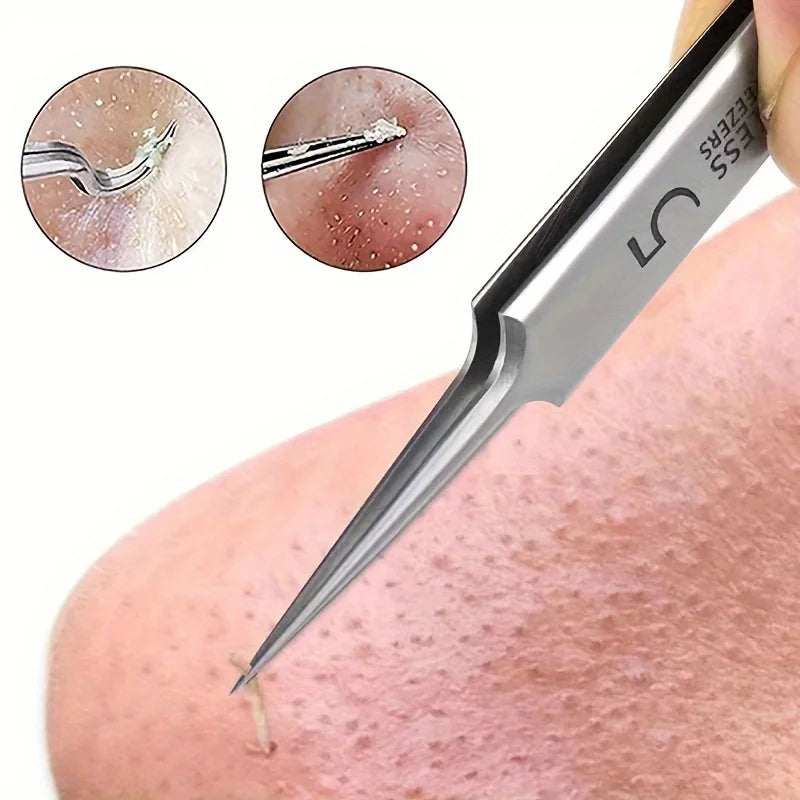 No. 5 Extra Fine Blackhead Removal Tweezers | Skincare Tool