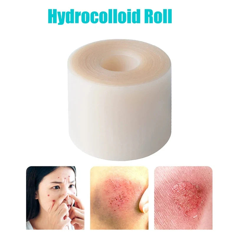 Hydrocolloid Roll Bandage – Waterproof Self-Adhesive Wound Care