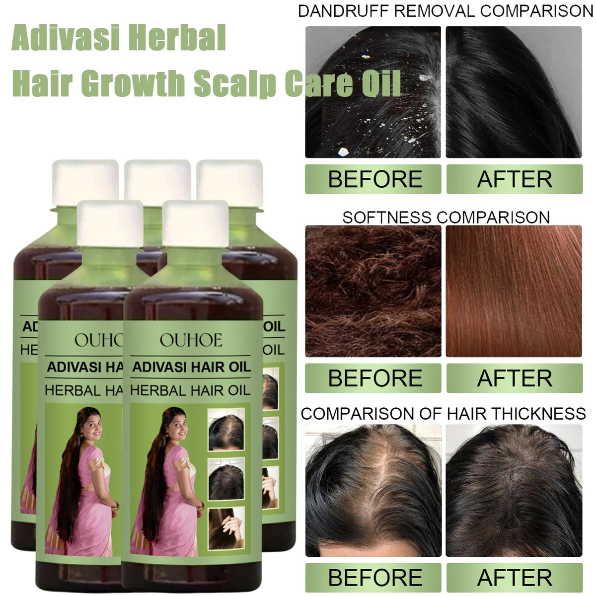 Adivasi Herbal Hair Growth Oil – Rosemary & Coconut 100ml