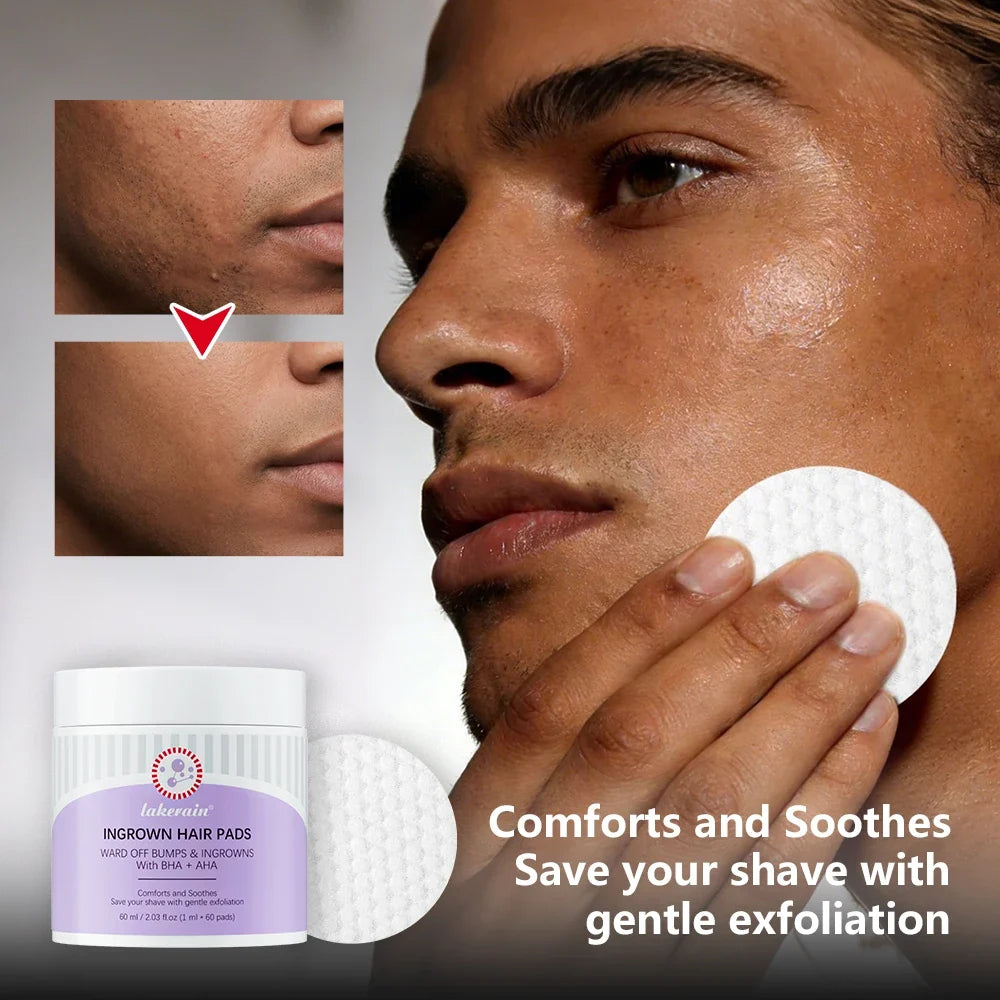 Ingrown Hair Exfoliating Pads – Aftershave Treatment | 60 Pads