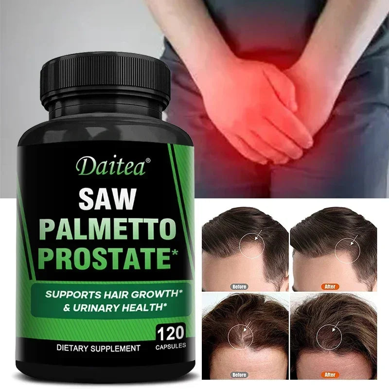Saw Palmetto Berry Extract Capsules – Hair & Hormone Support