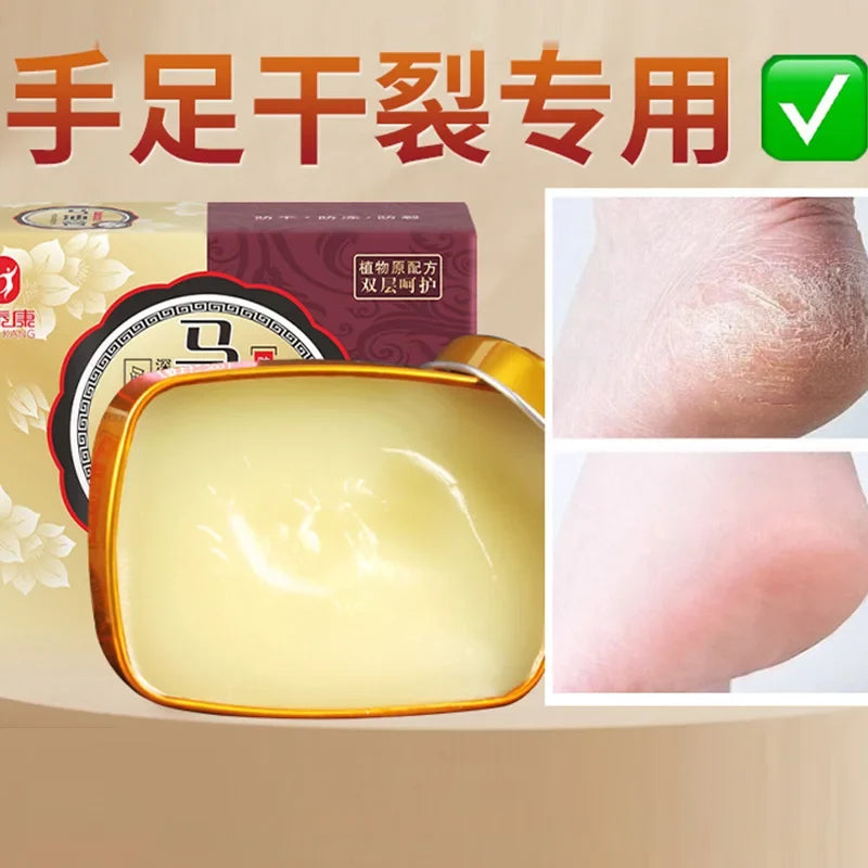 Jintai Kangma Horse Oil Cream – Hand & Foot Moisturizer 80g