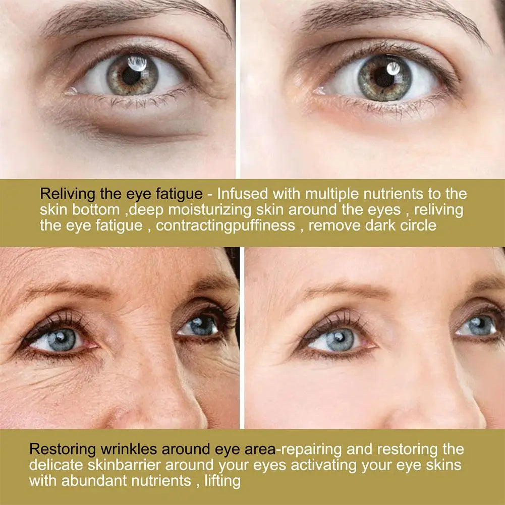 Hyaluronic Acid Microneedle Eye Patches – Under-Eye Gel Pads