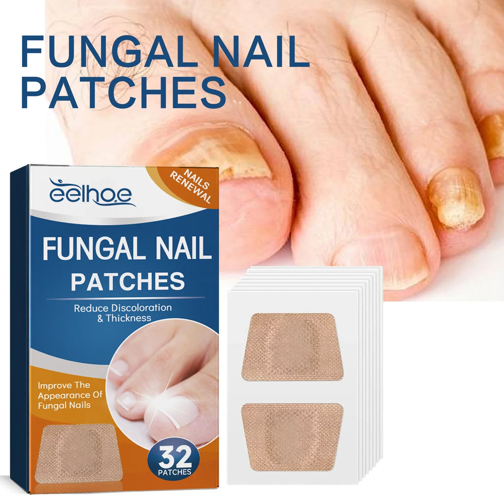 32-Piece Ingrown Toenail Correction Patches & Nail Repair Stickers