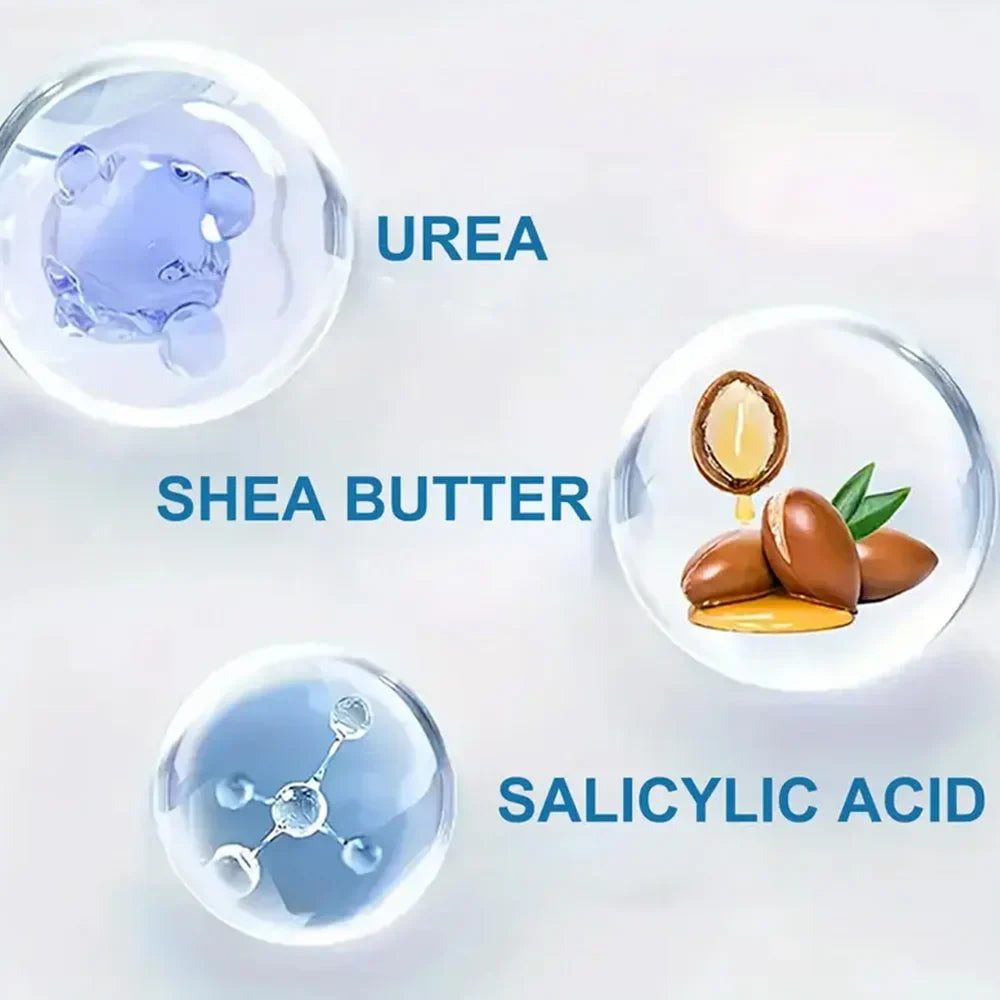 YOUNGCOME Urea Cream Salicylic Acid Hydrating Hand Foot Dry Skin Care