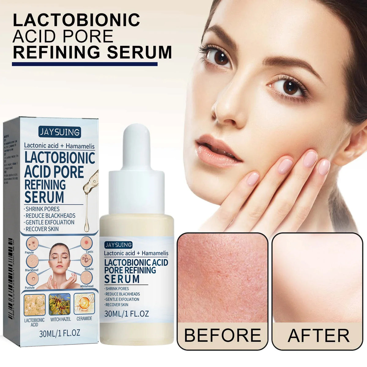 Jaysuing Lactic Acid Serum – Exfoliate, Tighten & Hydrate Skin