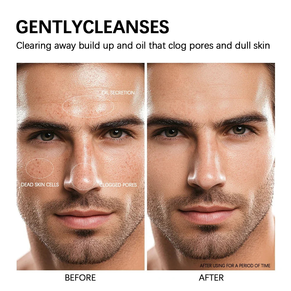 Glycolic Acid Clay Cleanser Deep Cleansing Face Wash 2-In-1 Mask