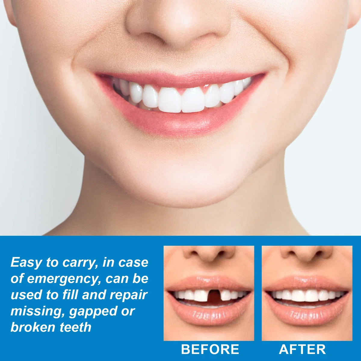 Jaysuing 30g Moldable Temporary Tooth Repair Gel Kit
