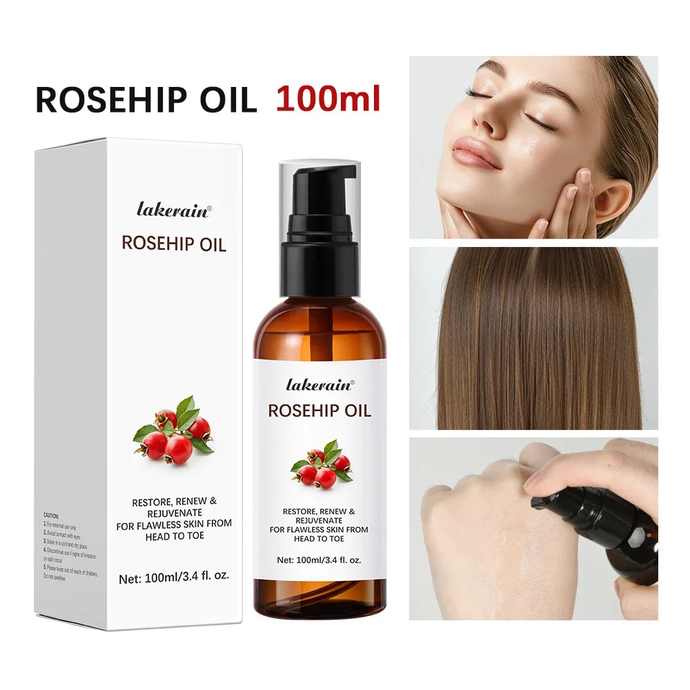 Organic Rosehip Oil 30ml – Face, Body & Hair Moisturizer
