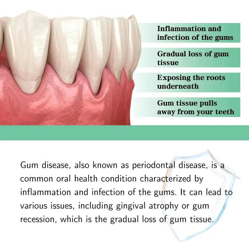 Gum Repair Gel – Plant Extract Toothpaste for Whiter Teeth