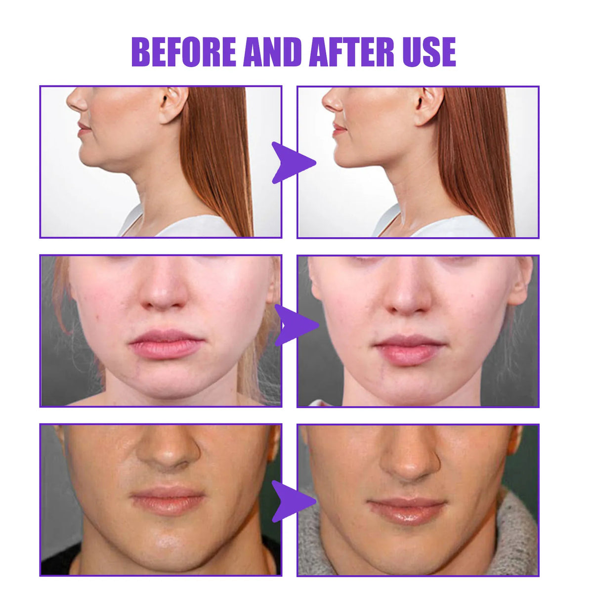 Jaysuing V-Shape Face Firming & Body Cream 30g