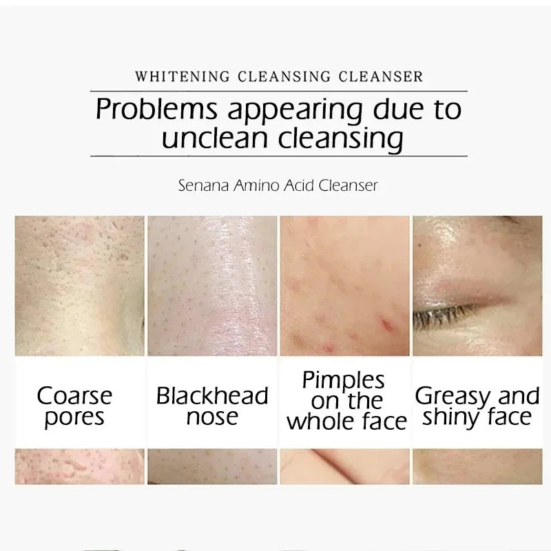 Nicotinamide Amino Acid Face Cleanser Facial Scrub Cleansing Acne Oil