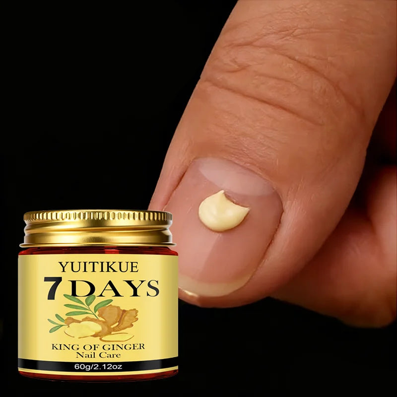 YUITIKUE Ginger King Nail Care Cream – 7-Day Results | 60g