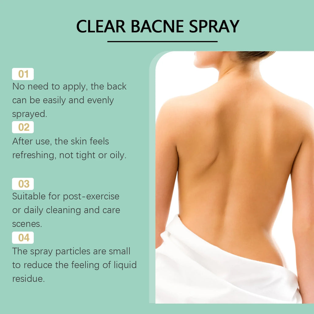 Back Acne Treatment Spray – Oil Control & Soothing Body Spray