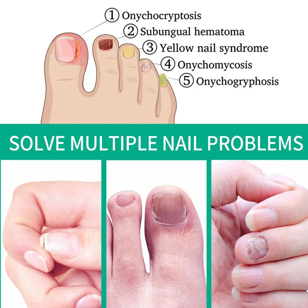10-Pack Nail Repair Serum Essence | Nail Care & Restoration