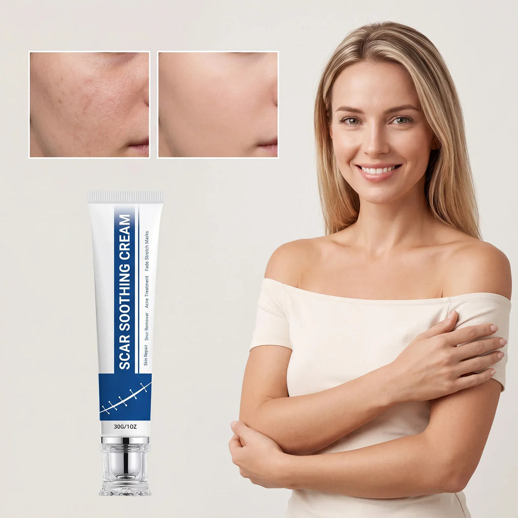 Soothing Scar Cream – Hydrating, Brightening & Skin Balancing