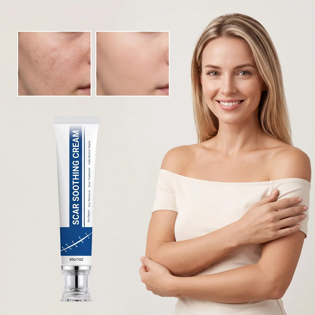 Soothing Scar Cream – Hydrating, Brightening & Skin Balancing