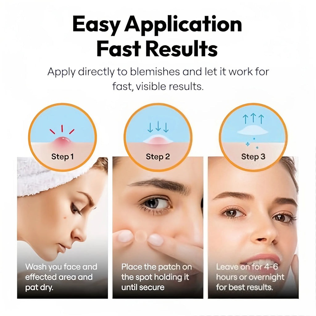 Hydrocolloid Acne Patches 24-Pack – Alcohol-Free Blemish Stickers