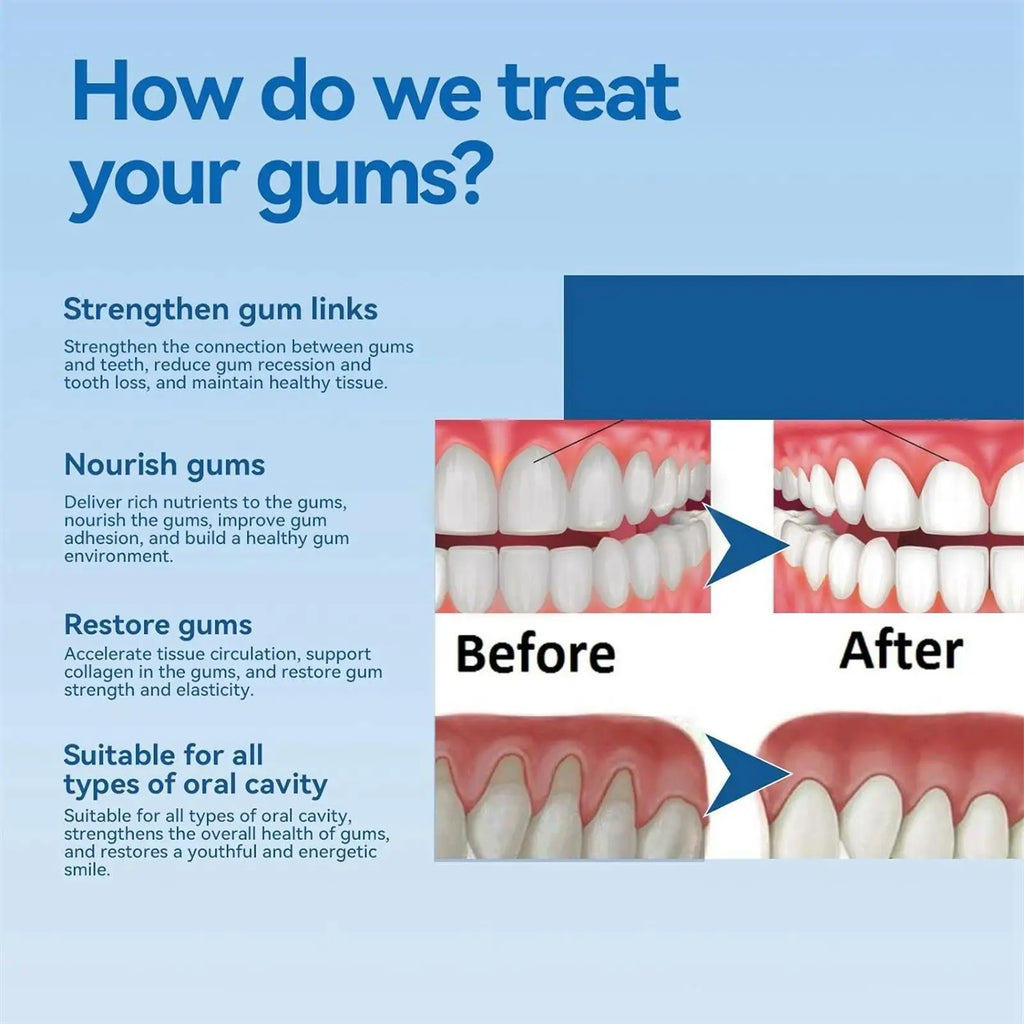 Eelhoe Gum Repair Gel Toothpaste – Tartar, Enamel & Gum Care